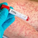 ¿Que es la Sífilis y como se contagia?