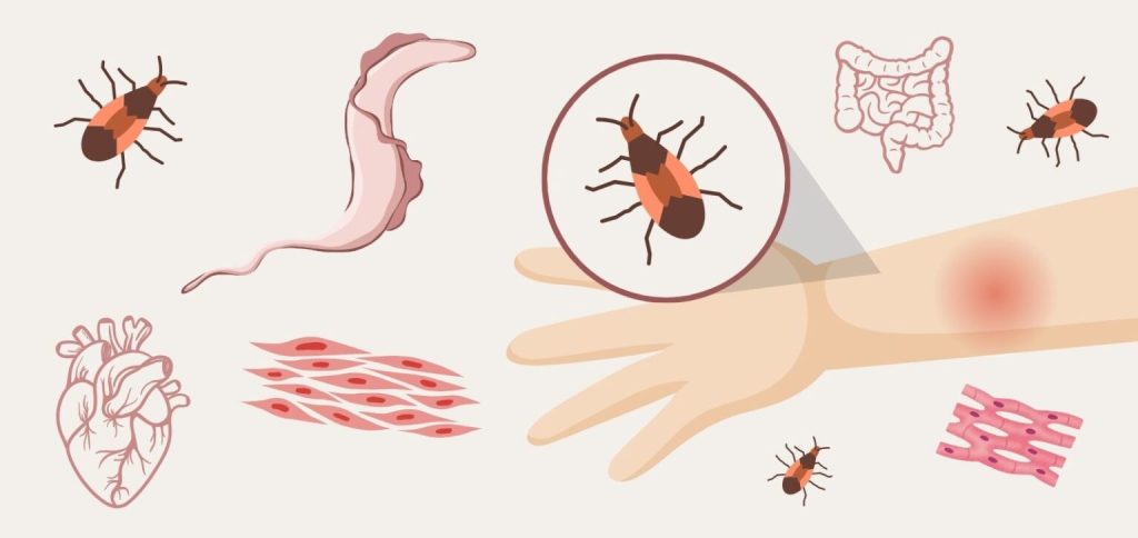 Fotos web DICCIONARI - Chagas Disease